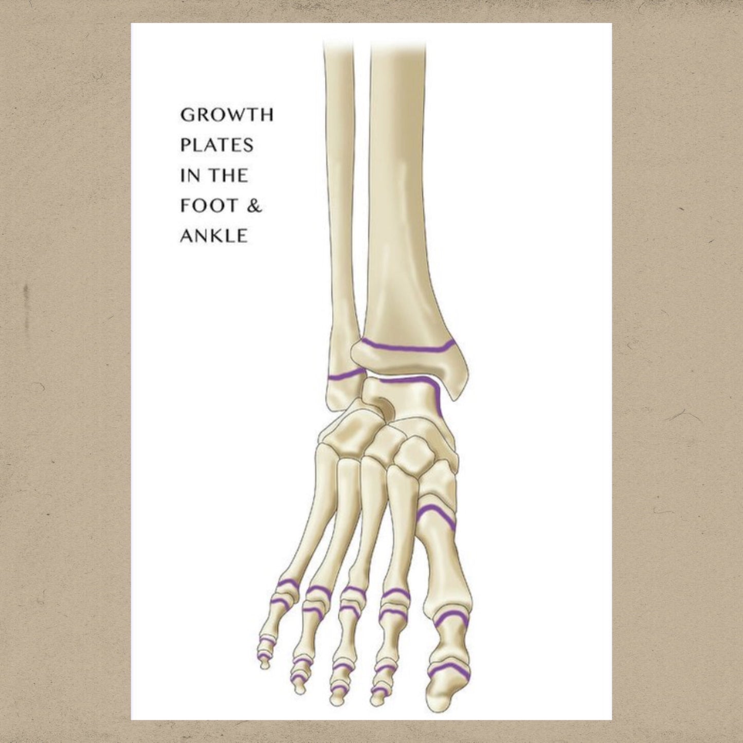 The Importance of Growth Plates in the Development of Your Child's Foot